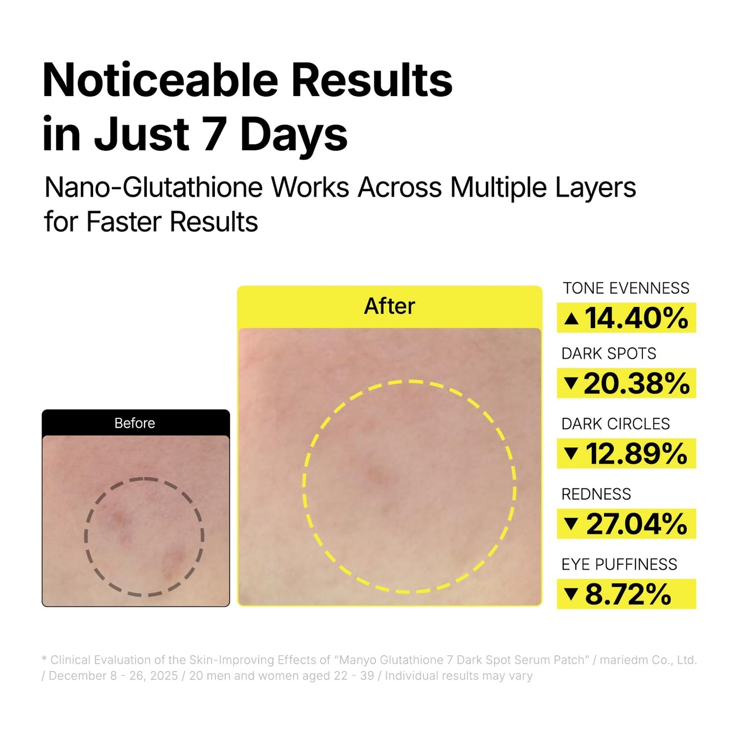 Furix™ Glutathione Dark Spot Serum Patches