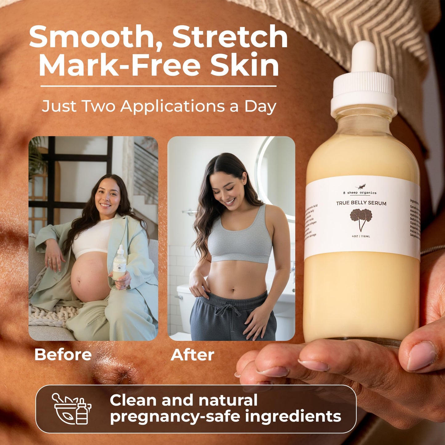 8 Sheep Stretch Mark Prevention Bundle