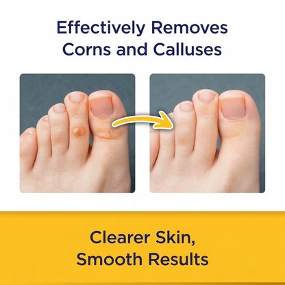 CornStick Callus Remover